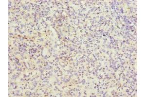 Immunohistochemistry of paraffin-embedded human spleen tissue using ABIN7156460 at dilution of 1:100 (ITGAL anticorps  (AA 201-500))