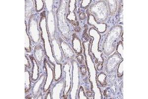Immunohistochemical staining of human kidney with ACSM1 polyclonal antibody  shows strong cytoplasmic positivity in cells in tubules at 1:20-1:50 dilution. (ACSM1 anticorps)