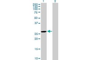 Western Blot analysis of DUPD1 expression in transfected 293T cell line by DUPD1 MaxPab polyclonal antibody.