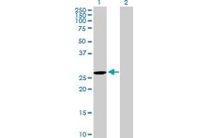 Western Blot analysis of DUPD1 expression in transfected 293T cell line by DUPD1 MaxPab polyclonal antibody. (DUPD1 anticorps  (AA 1-220))