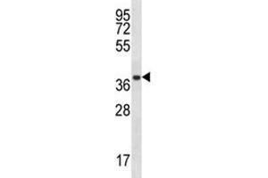 PSMA1 antibody western blot analysis in A2058 lysate. (PSMA1 anticorps  (AA 234-262))