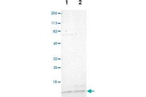 Western blot analysis of Lane 1: Human cell line RT-4, Lane 2: Human cell line U-251MG sp with TIMM9 polyclonal antibody  at 1:100-1:250 dilution.