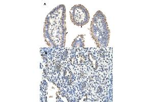 Immunohistochemical staining (Formalin-fixed paraffin-embedded sections) of (A) human intestine and (B) human lung tissues with KRT2 polyclonal antibody . (Keratin 2 anticorps  (AA 351-400))
