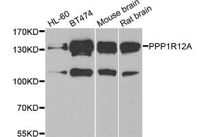 Western blot analysis of extracts of various cell lines, using PPP1R12A antibody (ABIN5974045) at 1/1000 dilution. (PPP1R12A anticorps)