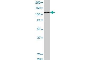 MCM3 monoclonal antibody (M03), clone 3E1.