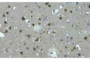 Immunohistochemistry of paraffin-embedded Human brain tissue using MAP2 Monoclonal Antibody at dilution of 1:200. (MAP2 anticorps)