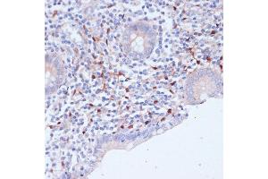 Immunohistochemistry of paraffin-embedded human appendix using WIPF1 antibody (ABIN7271348) at dilution of 1:100 (40x lens). (WIPF1 anticorps  (AA 400-500))