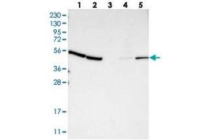 Western blot analysis of Lane 1: RT-4, Lane 2: U-251 MG, Lane 3: Human Plasma, Lane 4: Liver, Lane 5: Tonsil with KLHDC1 polyclonal antibody  at 1:250-1:500 dilution. (KLHDC1 anticorps)