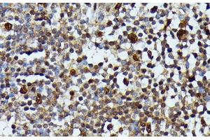 Immunohistochemistry of paraffin-embedded Human appendix using MAP3K3 Polyclonal Antibody at dilution of 1:100 (40x lens). (MAP3K3 anticorps)