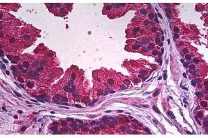 Human Prostate, Epithelium: Formalin-Fixed, Paraffin-Embedded (FFPE) (PDE9A anticorps)