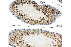 IHC-P: TIM-1 antibody testing of rat testis tissue