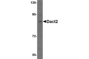 Western blot analysis of Dact2 in SK-N-SH cell lysate with AP30269PU-N Dact2 antibody at 1 μg/ml. (DACT2 anticorps  (N-Term))