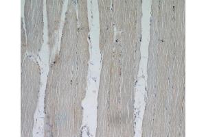 Immunohistochemistry (IHC) image for anti-Xin Actin-Binding Repeat Containing 2 (XIRP2) antibody (ABIN2906145) (XIRP2 anticorps)