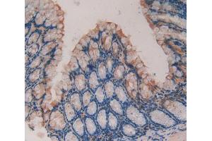 IHC-P analysis of intestine tissue, with DAB staining. (F13A1 anticorps  (AA 372-616))
