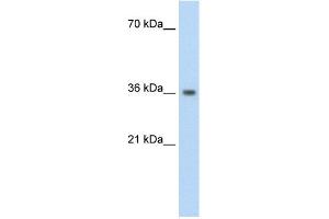 WB Suggested Anti-PHYHIP Antibody Titration:  1. (PHYHIP anticorps  (N-Term))