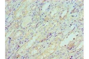 Immunohistochemistry of paraffin-embedded human kidney tissue using ABIN7148620 at dilution of 1:100 (SERPINA6 anticorps  (AA 136-405))