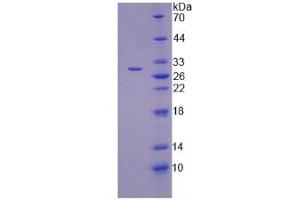 SDS-PAGE analysis of Human TNKS2 Protein. (TNKS2 Protéine)