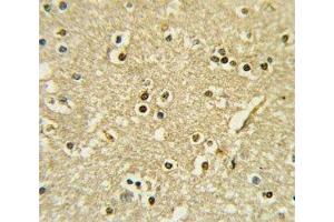 IHC analysis of FFPE human brain tissue stained with PAX6 antibody (PAX6 anticorps  (AA 183-210))