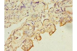 Immunohistochemistry of paraffin-embedded human placenta tissue using ABIN7146710 at dilution of 1:100 (CA13 anticorps  (AA 1-262))