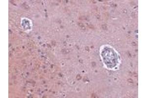 Immunohistochemistry of FAM120A in rat brain tissue with FAM120A antibody at 2. (FAM120A anticorps  (Center))