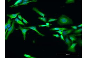 Immunofluorescence of purified MaxPab antibody to RELT on HeLa cell.