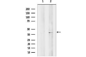 anti-Melanoma Antigen Family B, 3 (MAGEB3) (N-Term) antibody