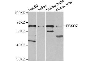 Western blot analysis of extracts of various cell lines, using FBXO7 antibody. (FBXO7 anticorps)