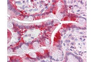 Anti-ALKBH3 antibody IHC of human small intestine.