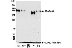 Western Blotting (WB) image for anti-Carcinoembryonic Antigen-Related Cell Adhesion Molecule 5 (CEACAM5) (AA 35-685) antibody (ABIN7453964)