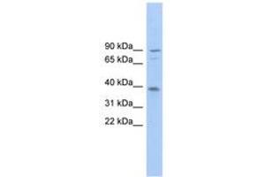 Image no. 1 for anti-Transmembrane Channel-Like 8 (TMC8) (AA 143-192) antibody (ABIN6745010) (TMC8 anticorps  (AA 143-192))
