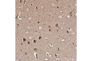 Immunohistochemical staining (Formalin-fixed paraffin-embedded sections) of human cerebral cortex with PRKACB polyclonal antibody  shows strong cytoplasmic positivity in neuronal cells. (PRKACB anticorps)