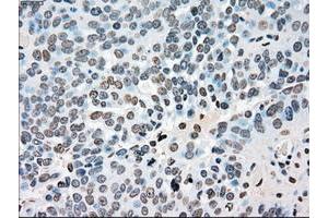 Image no. 4 for anti-Polo-Like Kinase 1 (PLK1) antibody (ABIN1500281)