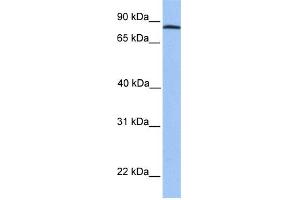 WB Suggested Anti-ADAM7 Antibody Titration: 0. (ADAM7 anticorps  (C-Term))