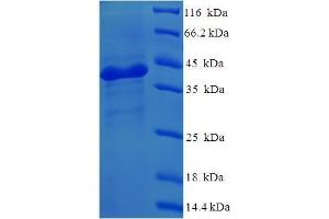 SDS-PAGE (SDS) image for Nicotinamide Nucleotide Adenylyltransferase 3 (NMNAT3) (AA 1-215), (Isoform 2) protein (His-SUMO Tag) (ABIN5711591)