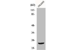 Western Blot analysis of COLO205 cells using Mob3B Polyclonal Antibody (MOBKL2B anticorps  (Internal Region))