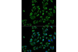 Immunofluorescence analysis of HeLa cells using PEX5 antibody (ABIN5973402). (PEX5 anticorps)