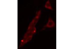 ABIN6268691 staining HeLa cells by IF/ICC. (TJP1 anticorps)