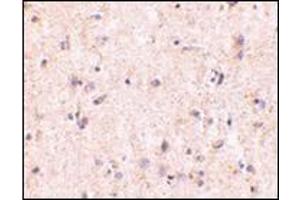 Immunohistochemistry of IRGM in human brain with this product at 5 μg/ml. (IRGM anticorps  (Center))