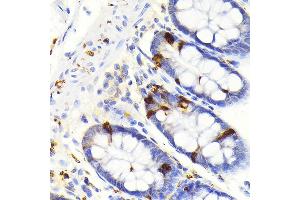 Immunohistochemistry of paraffin-embedded human colon using Secretagogin (Secretagogin (SCGN)) Rabbit mAb (ABIN7270178) at dilution of 1:100 (40x lens).