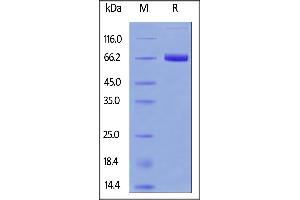 Fed Human Mesothelin (296-580), Fc Tag on  under reducing (R) condition.
