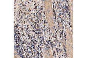 IHC analysis of Gephyrin/GPHN using anti-Gephyrin/GPHN antibody (ABIN7600086). (Gephyrin anticorps  (AA 148-736))