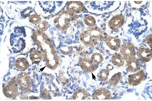 Rabbit Anti-CBX 4 Antibody Catalog Number: ARP30002 Paraffin Embedded Tissue: Human Kidney Cellular Data: Epithelial cells of renal tubule Antibody Concentration: 4. (CBX4 anticorps  (N-Term))