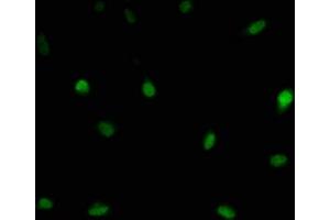 Immunofluorescence staining of U251 cells with ABIN7174212 at 1:166, counter-stained with DAPI.