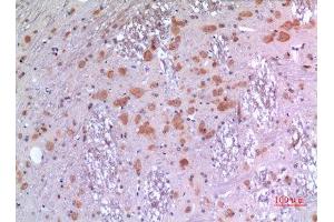 Immunohistochemistry (IHC) analysis of paraffin-embedded Rat Brain, antibody was diluted at 1:100. (BMP8A anticorps  (Internal Region))