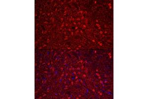 Immunofluorescence analysis of rat brain using Calretinin Rabbit pAb (ABIN6129247, ABIN6137849, ABIN6137850 and ABIN6225108) at dilution of 1:250 (40x lens). (Calretinin anticorps  (AA 1-271))