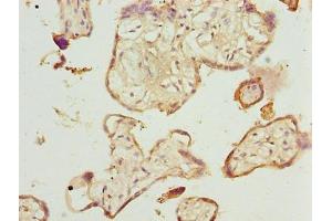 Immunohistochemistry of paraffin-embedded human placenta tissue using ABIN7173063 at dilution of 1:100 (TMEM143 anticorps  (AA 8-278))