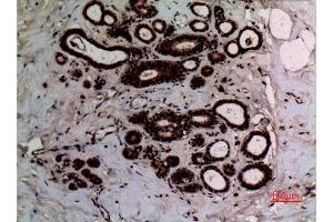 Immunohistochemistry (IHC) analysis of paraffin-embedded Human Breast, antibody was diluted at 1:100.