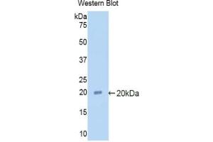 Detection of Recombinant a2PI, Rat using Polyclonal Antibody to Alpha 2-Antiplasmin (a2PI) (a2PI (AA 348-491) anticorps)