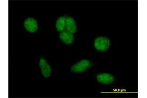 Immunofluorescence of purified MaxPab antibody to C1orf181 on HeLa cell.