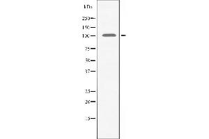 Western blot analysis of extracts from HeLa cells using AMPD2 antibody. (AMPD2 anticorps  (N-Term))